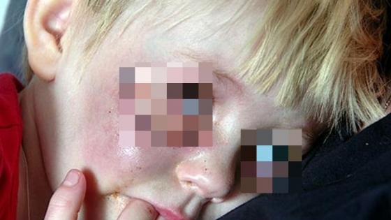 Cutremurator: un baietel de 12 ani a fost mutilat pentru ca nu avea culoarea corecta a ochilor