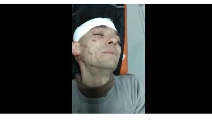Video: Un bărbat din Hâncești a fost bătut cu Bestialitate pentru comentarii pe Internet