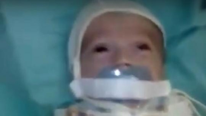 Imagini ŞOCANTE într-un spital din Rusia cu un copil care avea suzeta prinsă CU LIPICI de gură