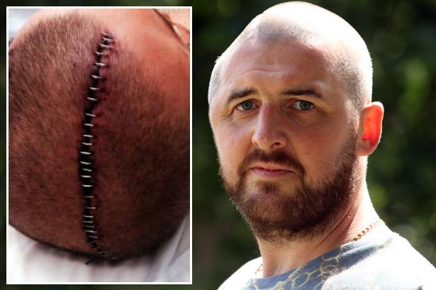 DJ suffers horrific injuries and left unable to listen to music after one-punch attack