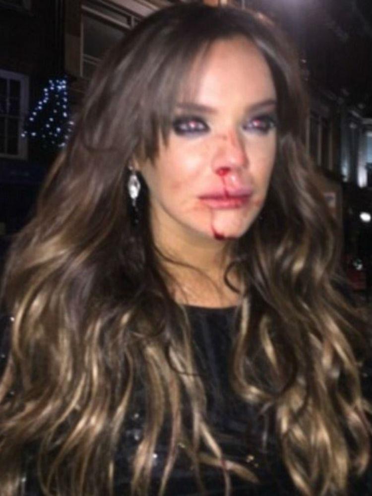 Reality Star Maria Fowler Pictured Bloodied And Bruised After Vicious Attack