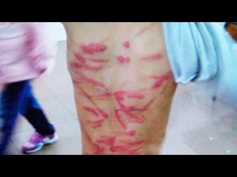 LEGAL BEATING?: Chinese Mother Escapes Charges After Beating 6 Year Old Son Over Homework